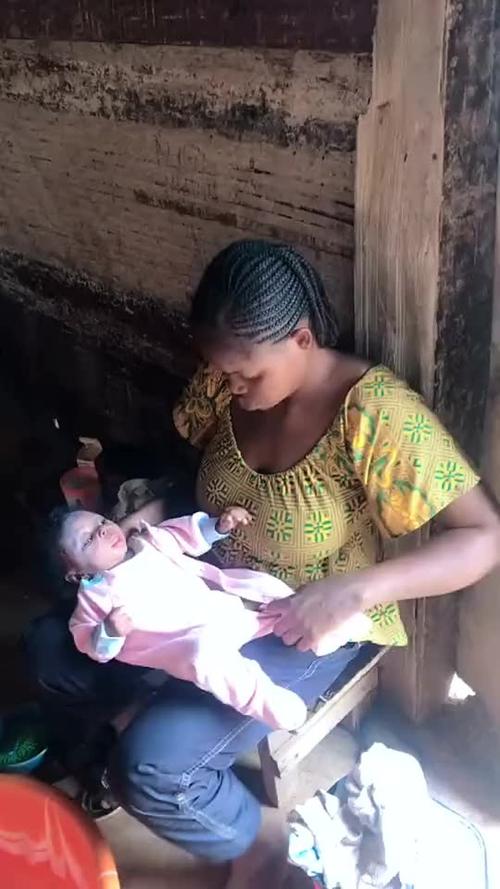 非洲生孩子难产按压肚子的视频